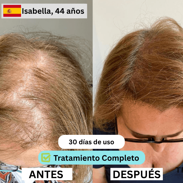 ES 1