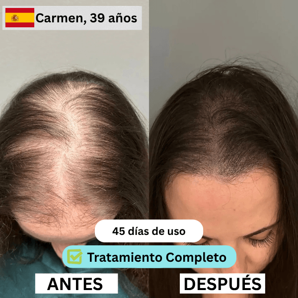 ES 2