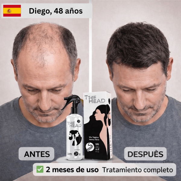 ES 3