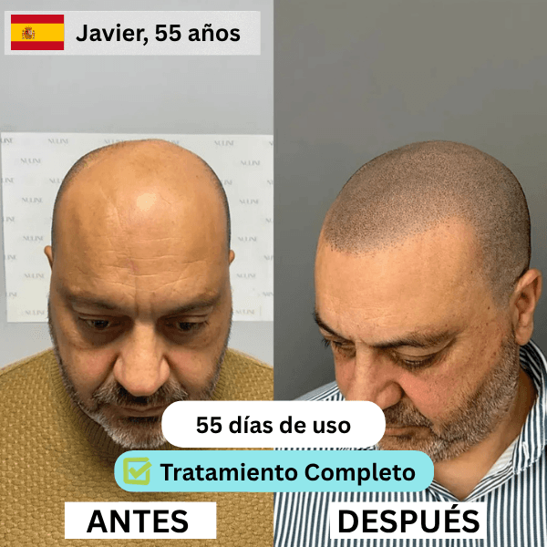 ES 4