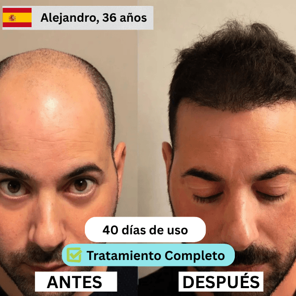ES 5
